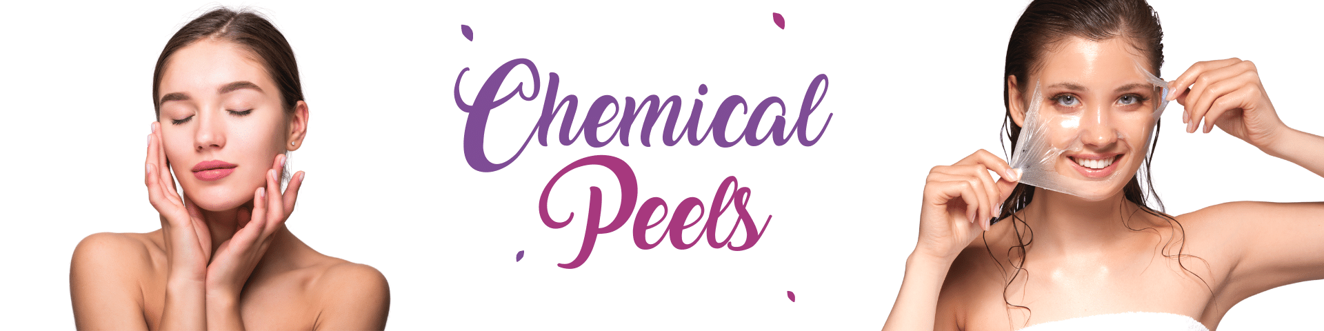 Chemical Peels banner