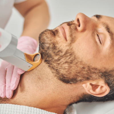 Laser Beard Shaping