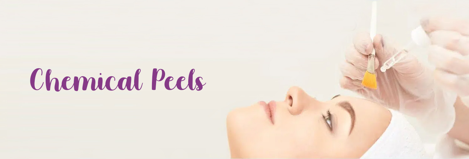 Chemical Peels